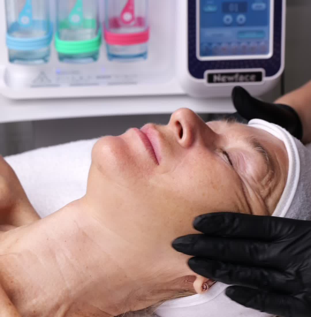 Kemisk peeling-behandling hos LightPulse Kungälv